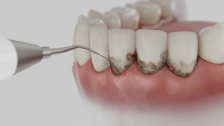Trusted Dental Implants service in Pharr, TX - Dentist Open Now
